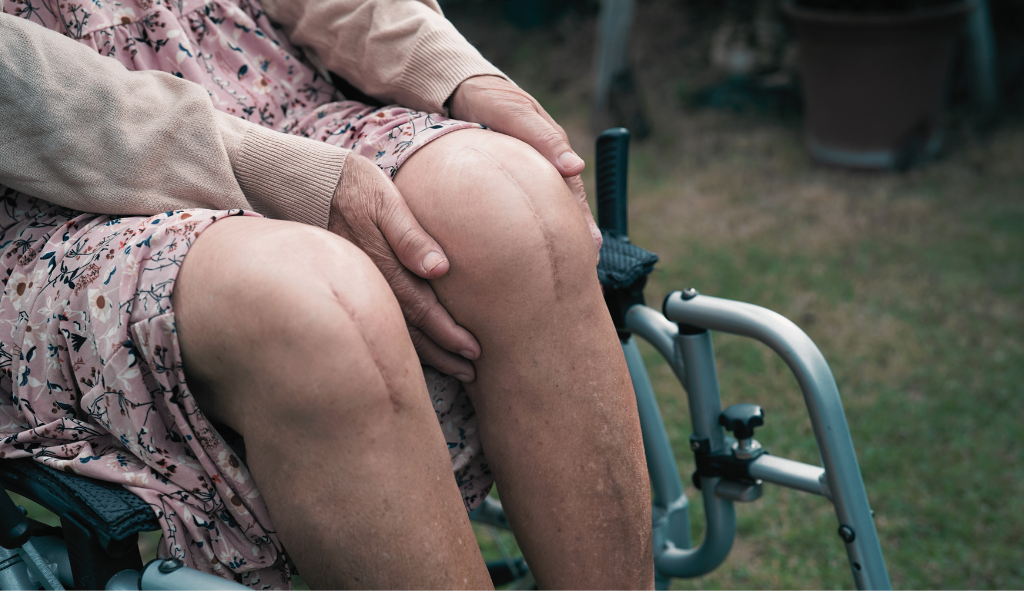 knee
