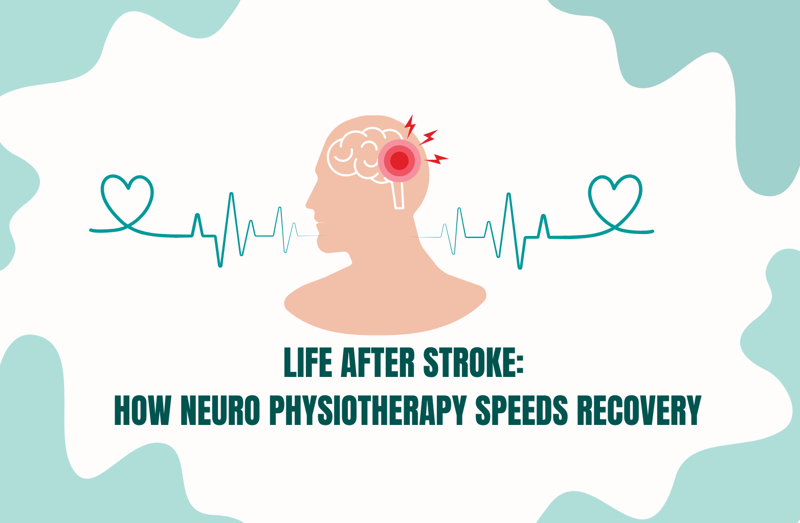 Life After Stroke Recovery with Home Neuro Physiotherapy